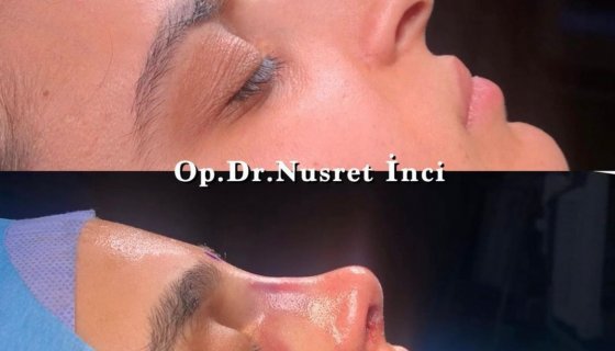 Op.Dr.Nusret İnci