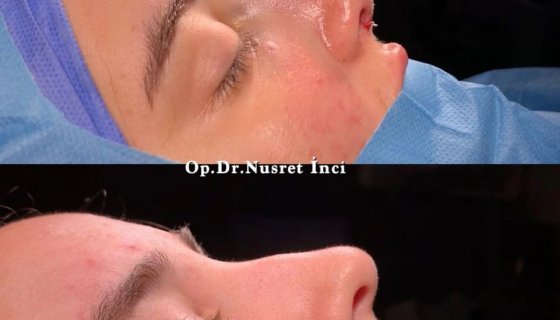Op.Dr.Nusret İnci