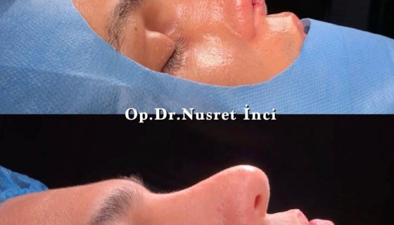 Op.Dr.Nusret İnci
